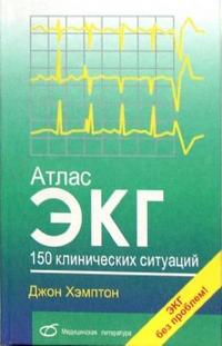 Атлас ЭКГ. 150 клинических ситуаций, Хэмптон Джон, 2008